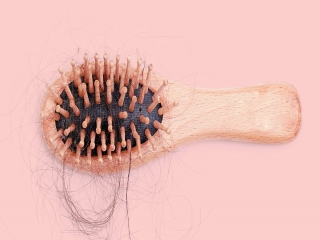 ریزش مو؛ علت ، جلوگیری و درمان