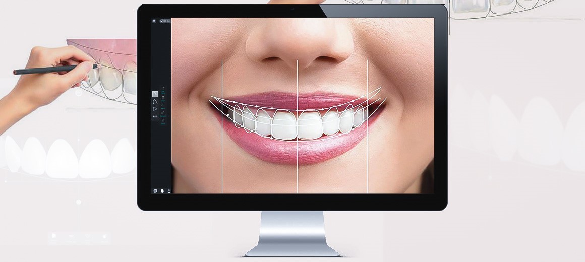 چرا ایمپلنت دیجیتال بهترین روش برای جایگزینی دندان است؟ چرا ایمپلنت دیجیتال بهترین روش برای جایگزینی دندان است؟