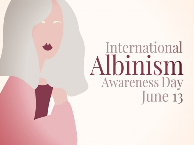 13 ژوئن، روز جهانی آگاهی از آلبینیسم (زالی)