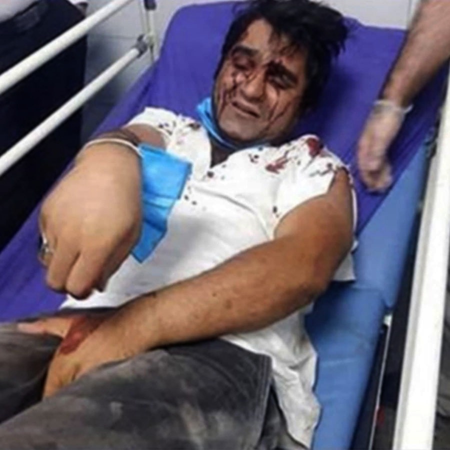 ضرب و شتم بازیگر «دودکش» به دلیل تبلیغات انتخابات ریاست جمهوری 1400