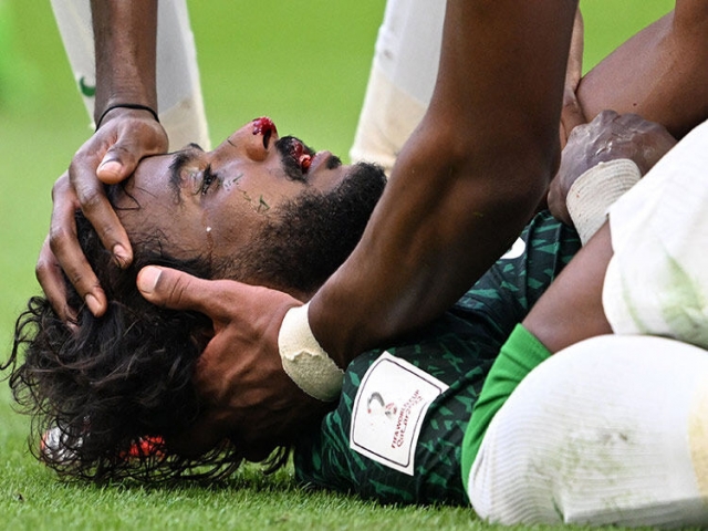 مدافع عربستان جام جهانی را از دست داد