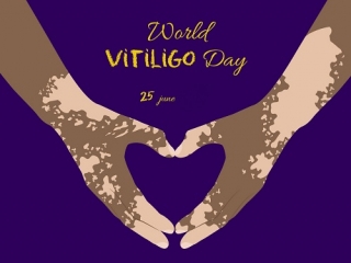 روز جهانی بیماری ویتیلیگو