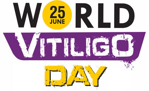 روز جهانی ویتیلیگو