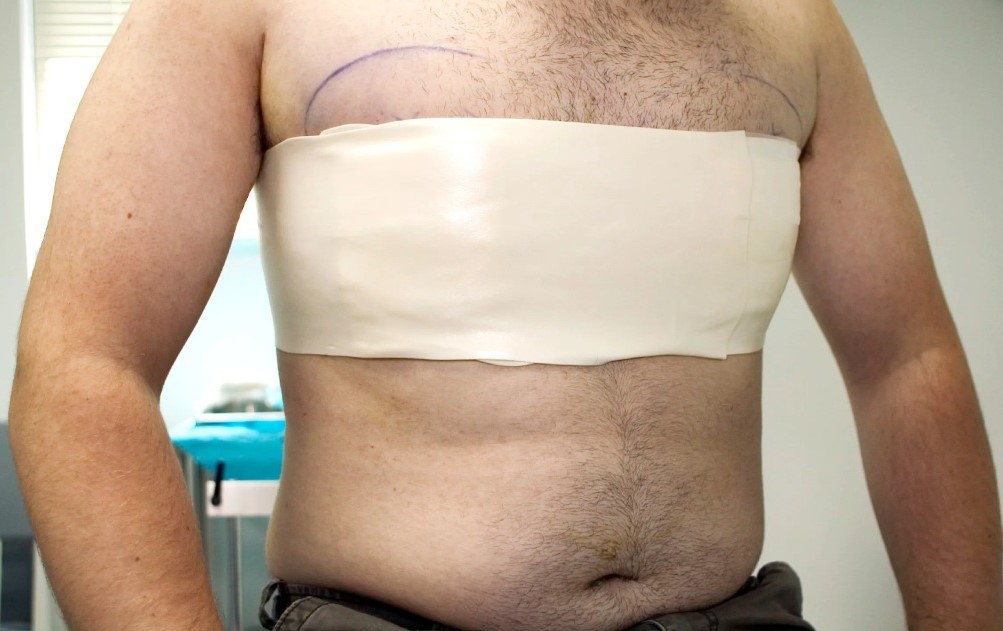 جراحی زیبایی سینه: تحول و بهبود شکل و اندازه سینه
