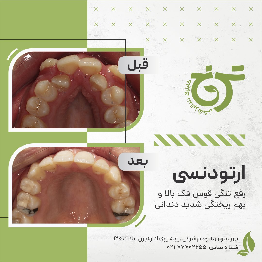 بهترین متخصص ارتودنسی در تهران