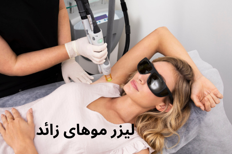 لیزر موهای زائد چیست؟