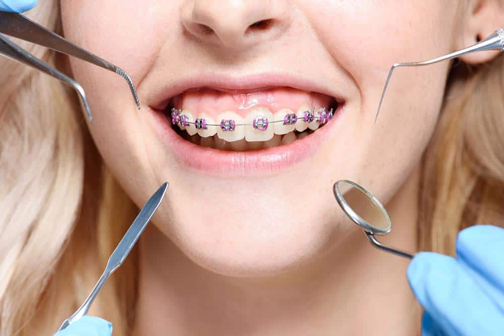ارتودنسی چیست؟