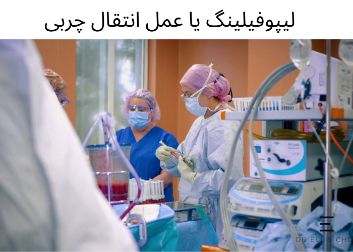 عمل لیپوفیلینگ چیست و چگونه انجام می‌شود؟