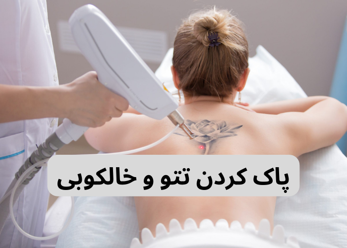 پاک کردن تتو و خالکوبی