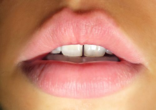 چگونه بدون هزینه دندانهایی سفیدتر داشته باشیم؟