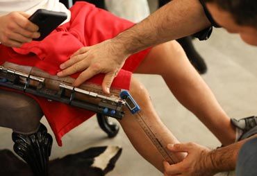 عمل جراحی افزایش قد خطر دارد !