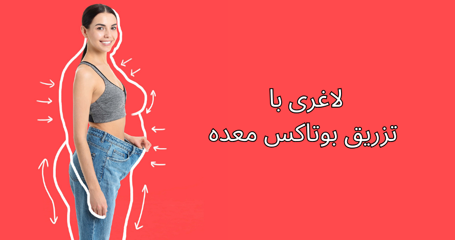 تجربیات واقعی افراد با تزریق بوتاکس معده، 20 کیلو در 6 ماه؟