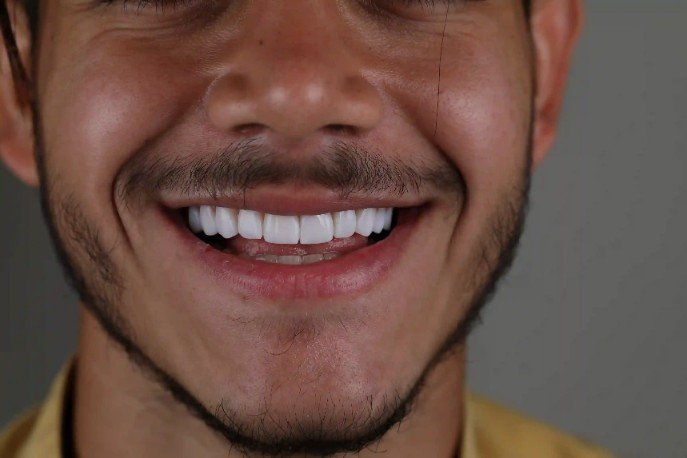 دندانپزشکی زیبایی چیست؟ ویژگی های متخصص دندانپزشکی زیبایی