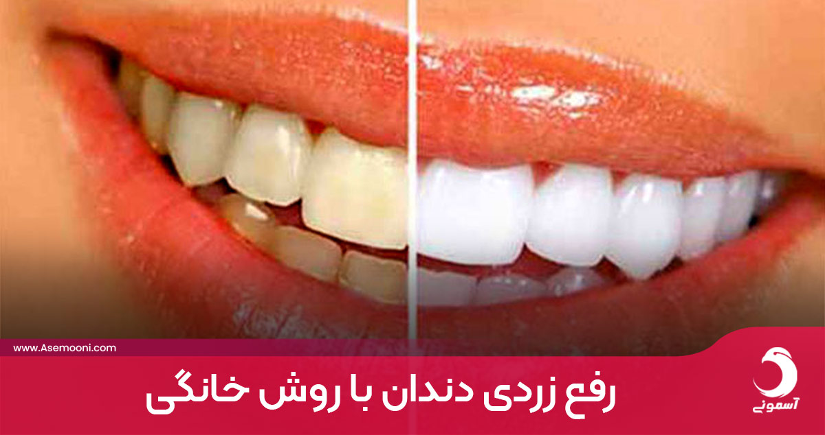 رفع زردی دندان با روش خانگی
