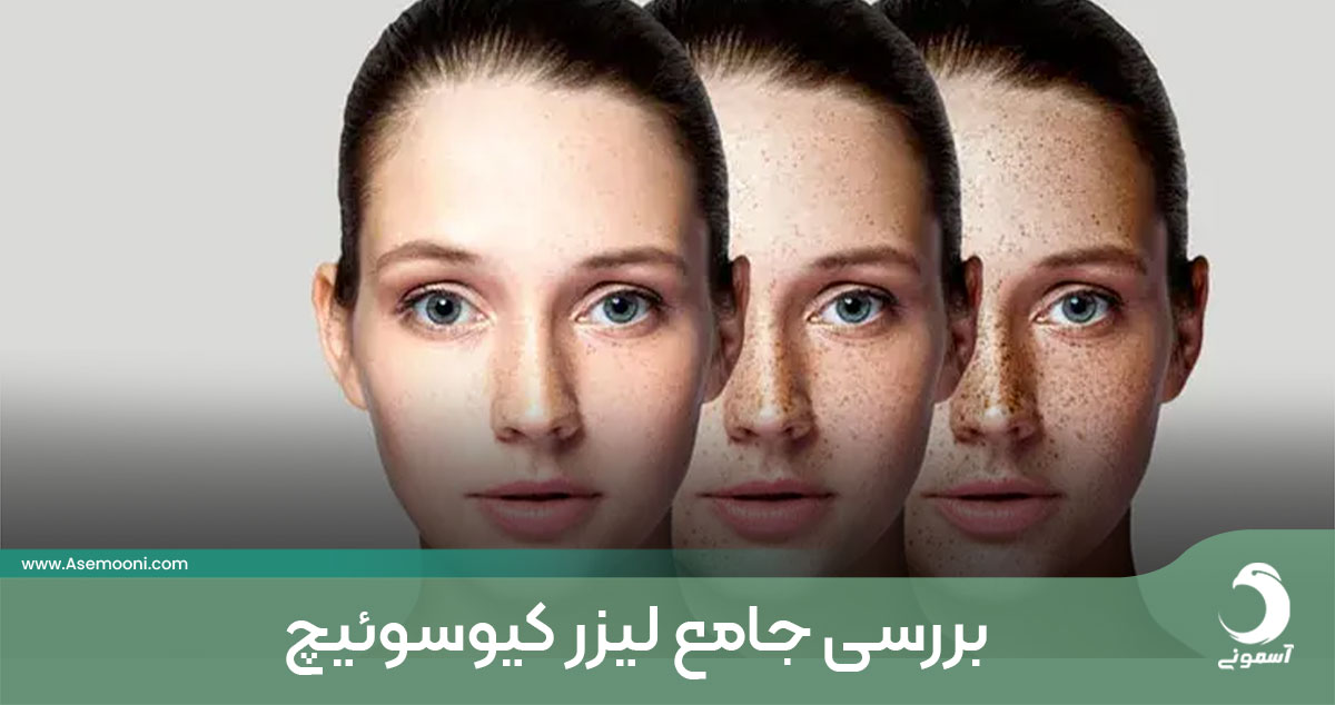 بررسی جامع لیزر کیوسوئیچ