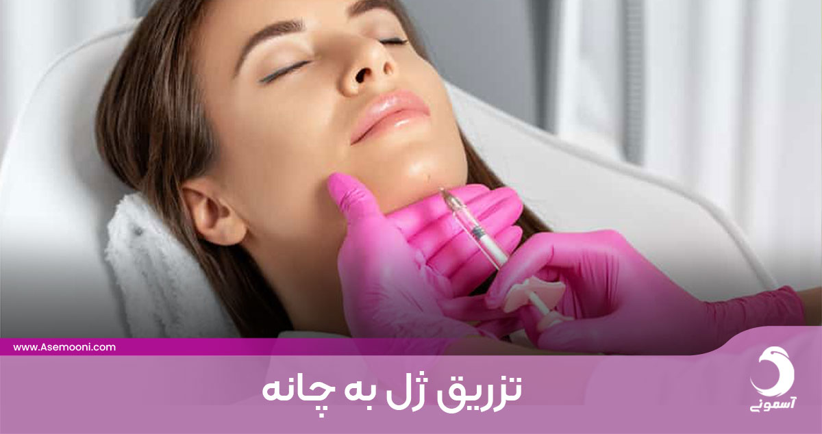 تزریق ژل به چانه؛ روشی برای زیبایی صورت بدون نیاز به عمل جراحی