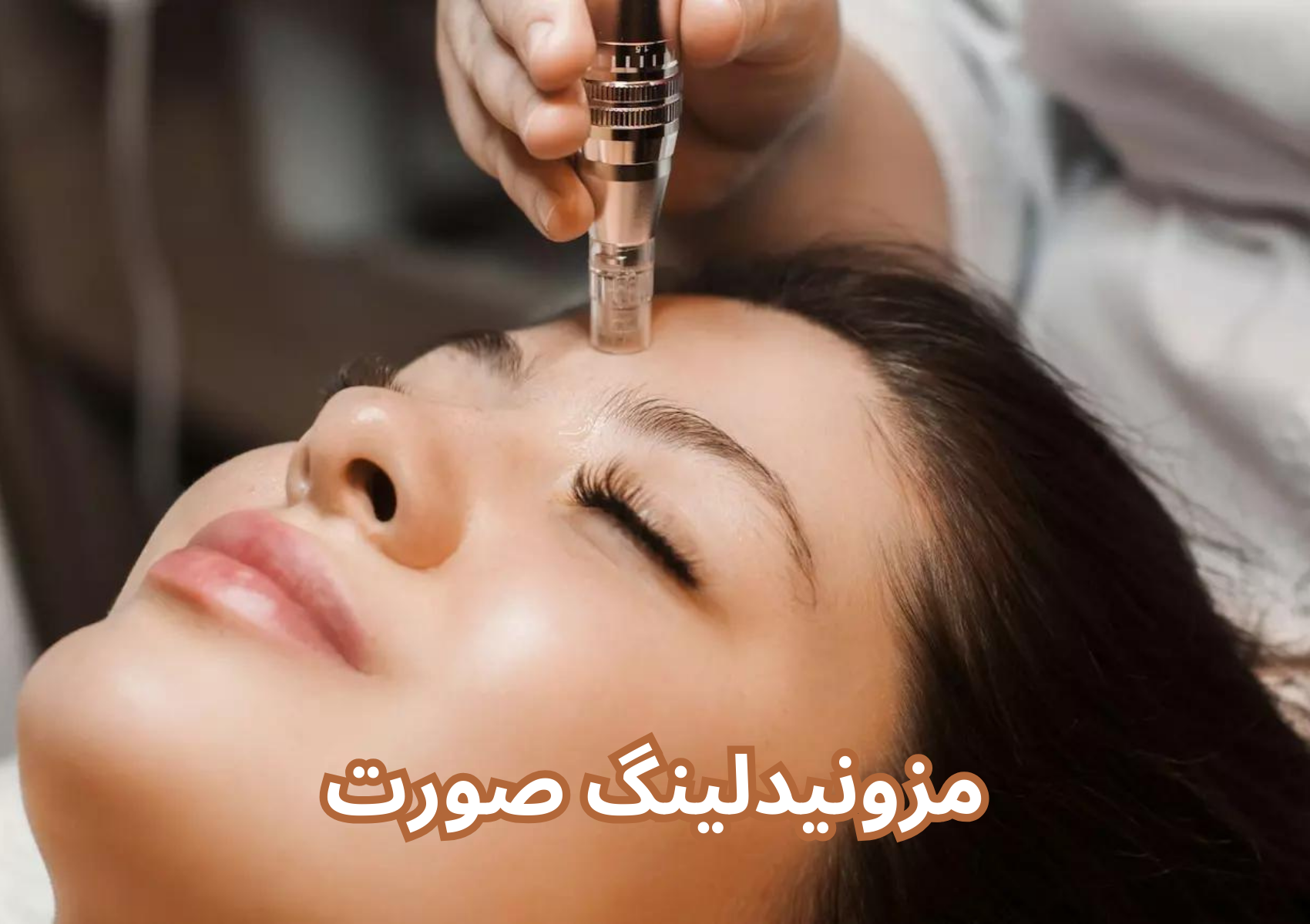 مزونیدلینگ صورت چیست
