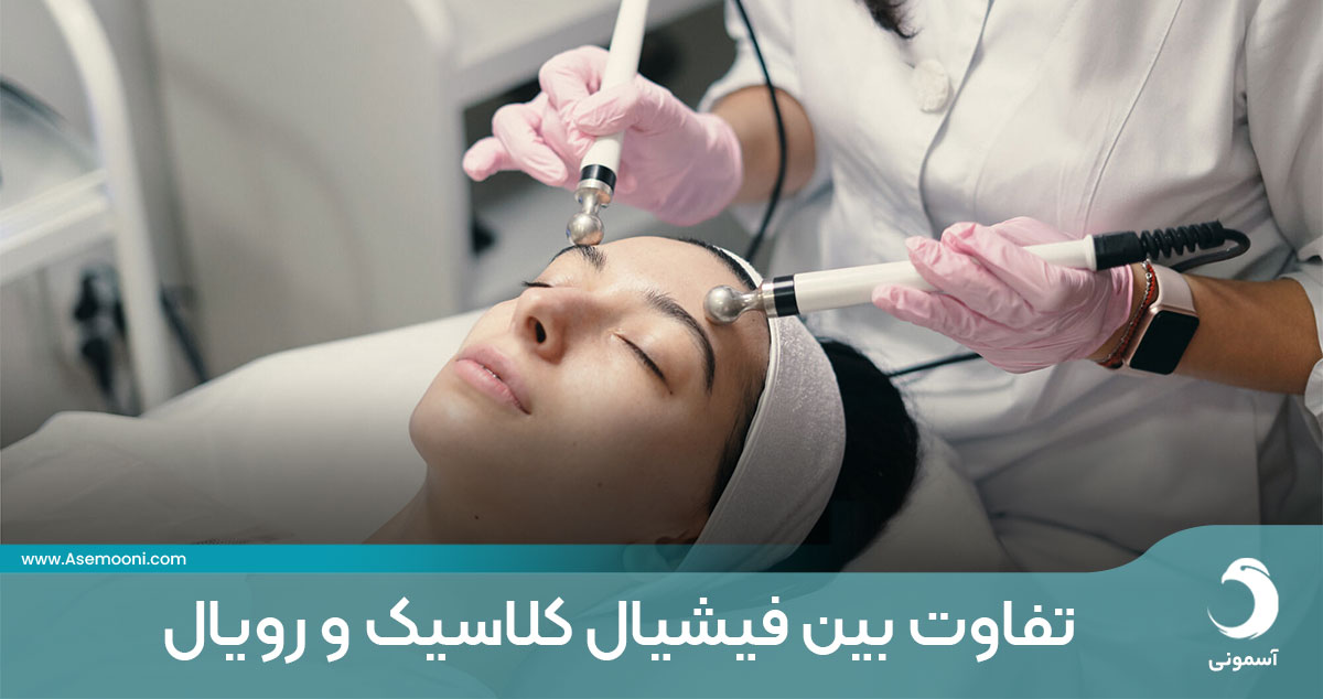 تفاوت بین فیشیال کلاسیک و فیشیال رویال
