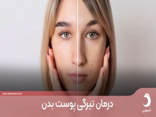آموزش روش های رفع تیرگی پوست بدن