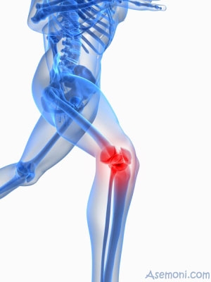 ورزش و زانو درد