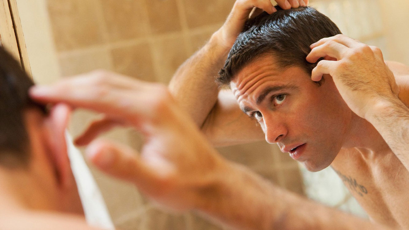 درمان ریزش موی مردان - بخش اول