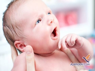 دندان های مولودی در چه نوزادانی شایع است ؟