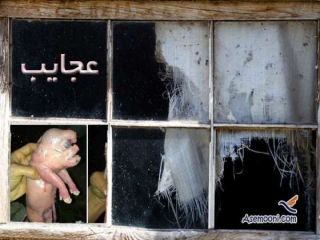 اتفاقی عجیب که دنیا را لرزاند، به دنیا آمدن نوزاد به شکل خوک