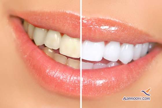 Whiten teeth with banana peel(3)