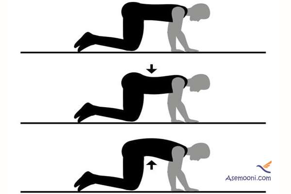 treatment-hunched-back-with-exercise(1)