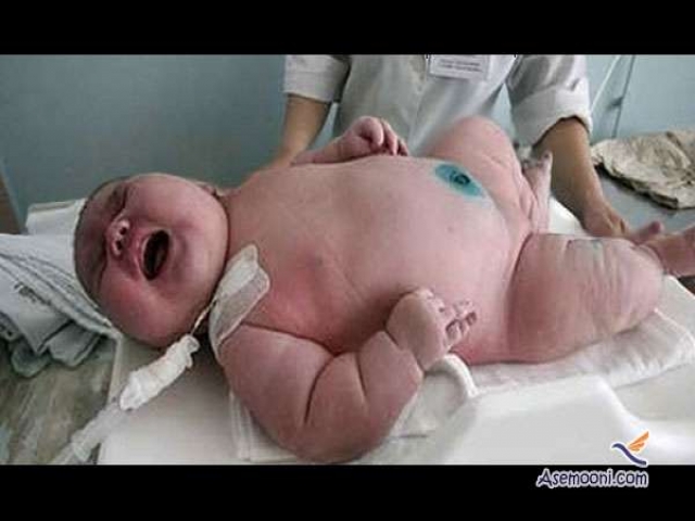 چاق ترین نوزاد دنیا به دنیا آمد