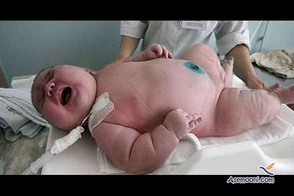 the-worlds-most-obese-baby-was-born