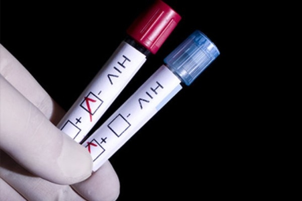 بهترین زمان برای آزمایش HIV بعد از رابطه جنسی