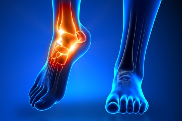 علت و درمان درد کف پا چیست؟