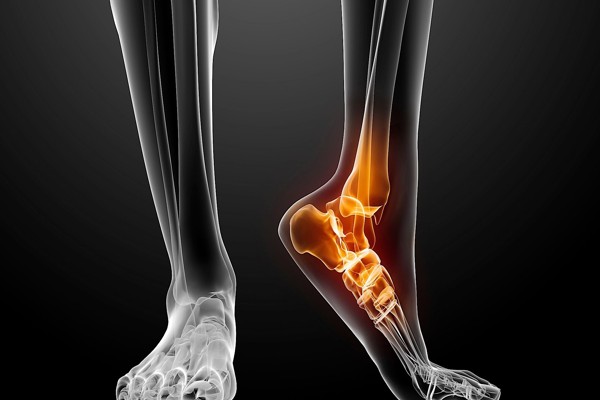 Foot pain(4)