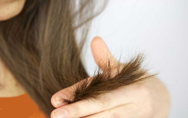چطور از شر موخوره رها شویم؟