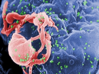 تنها 30 هزار و 183 نفر از بیماری ایدز خود در کشور اطلاع دارند