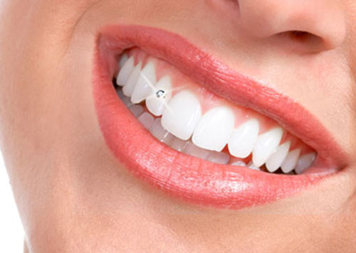 7مد زیبایی که سلامت دندان‌های‌تان را نشانه گرفته‌اند