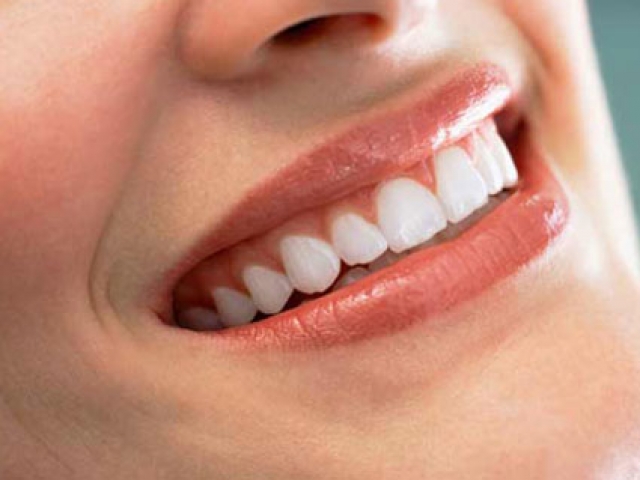 پنج ترفند خانگی برای سفید کردن دندان ها
