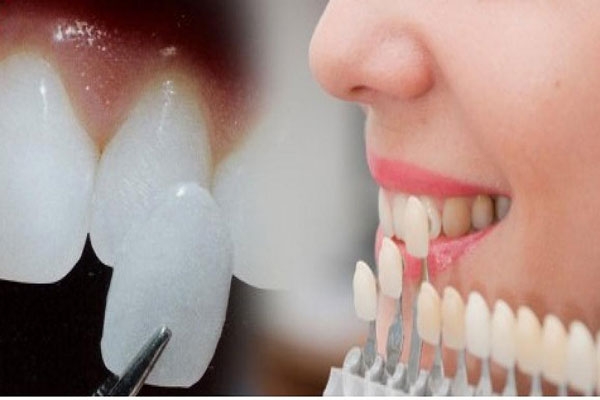 دندانپزشکی زیبایی چیست؟