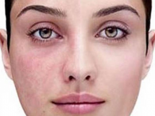 وضعیت سلامتی خود را از این نطقه بدن بفهمید وضعیت سلامتی خود را از این نطقه بدن بفهمید