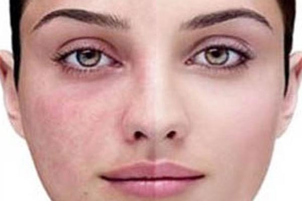 وضعیت سلامتی خود را از این نطقه بدن بفهمید