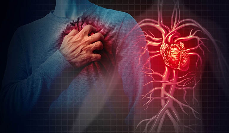 دلایل عجیب و باورنکردنی سکته قلبی + پیشگیری