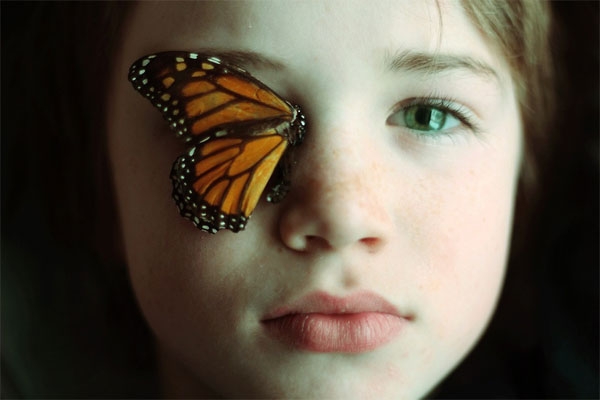 با بیماری پروانه ای آشنا شوید