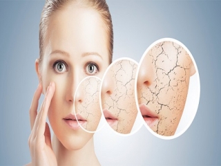 علت اصلی و درمان خشکی پوست