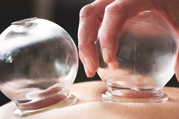 is-cupping-therapy-is-really-effective1