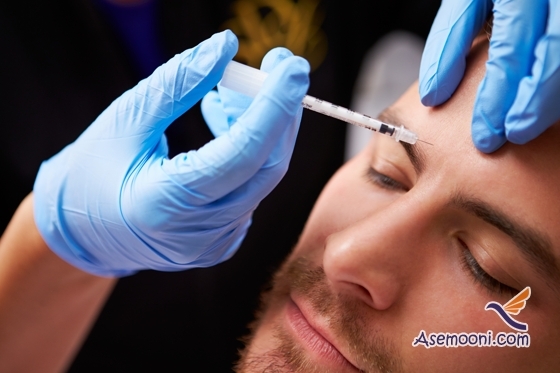 همه چیز درباره بوتاکس