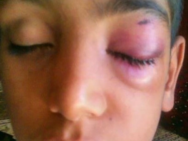 تنبیه بدنی دانش‌آموزی بمپوری را روانه بیمارستان کرد