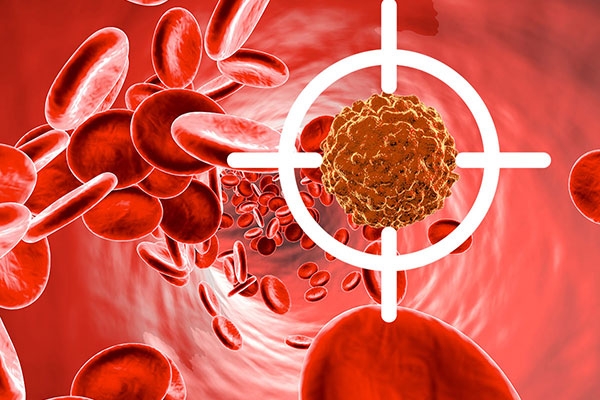 نشانه ها و علائم خاموش سرطان خون