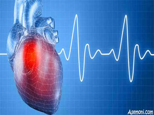 علائم سکته قلبی علائم سکته قلبی