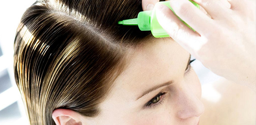درمان ریزش موی زنان